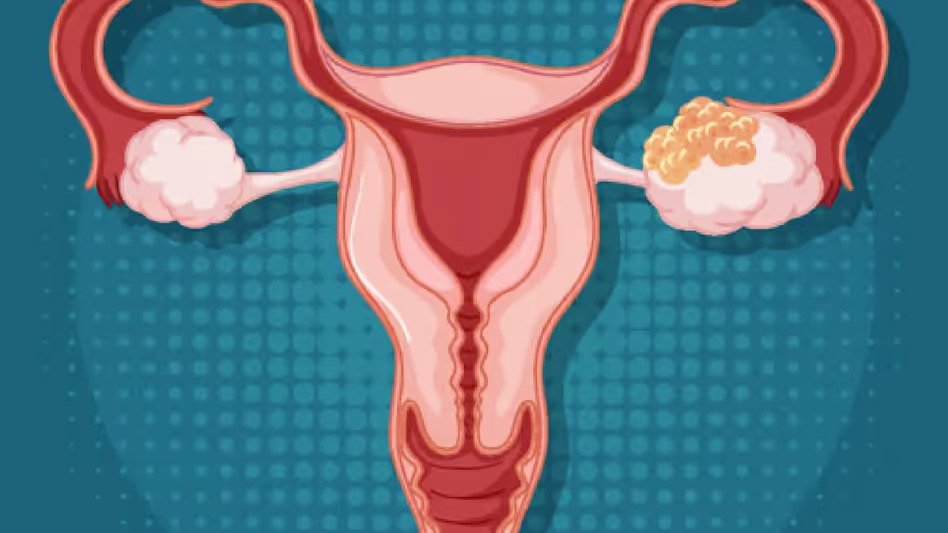 best doctor for gynecological cancer treatment in Noida