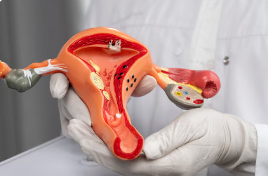 Best Uterus Removal Treatment Noida