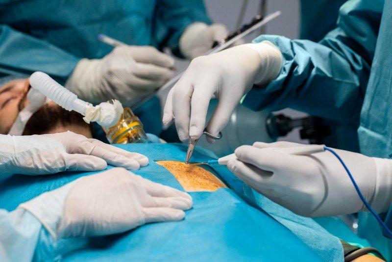 Best Laparoscopic Surgeries for Ectopic and Ovarian Cyst in Noida